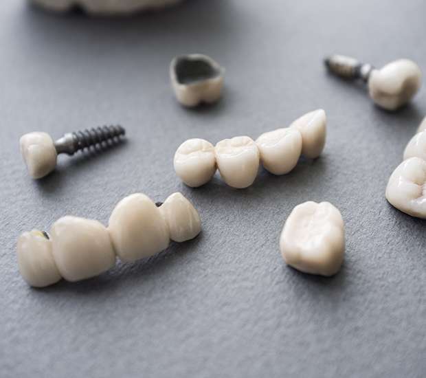 Manalapan Township The Difference Between Dental Implants and Mini Dental Implants